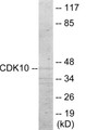 Western blot analysis of extracts from 293 cells, using CDK10 Antibody. The lane on the right is treated with the synthesized peptide.