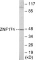 Western blot analysis of extracts from HeLa cells, using ZNF174 Antibody.