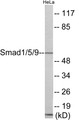 Western blot analysis of extracts from HeLa cells, using Smad1/5/9 Antibody. The lane on the right is treated with the synthesized peptide.