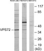 Western blot analysis of extracts from RAW264.7/NIH-3T3 cells, using VPS72 Antibody.