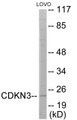 Western blot analysis of extracts from LOVO cells, using CDKN3 Antibody. The lane on the right is treated with the synthesized peptide.