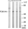 Western blot analysis of extracts from HeLa/HepG2/COLO205/293 cells, using PFKFB1/4 Antibody. The lane on the right is treated with the synthesized peptide.