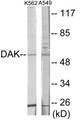 Western blot analysis of extracts from K562/A549 cells, using DAK Antibody. The lane on the right is treated with the synthesized peptide.