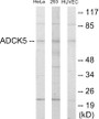 Western blot analysis of extracts from HeLa/293/HuvEc cells, using ADCK5 Antibody. The lane on the right is treated with the synthesized peptide.