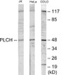 Western blot analysis of extracts from Jurkat cells/COLO205 cells/HeLa cells/HuvEc cells, using PLCH Antibody.