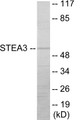 Western blot analysis of extracts from COLO205 cells, using STEA3 Antibody.