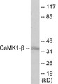 Western blot analysis of extracts from LOVO cells, treated with H2O2 100uM 30’, using CaMK1-beta Antibody.