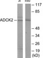 Western blot analysis of extracts from Jurkat/K562 cells, using ADCK2 Antibody. The lane on the right is treated with the synthesized peptide.