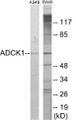 Western blot analysis of extracts from A549/RAW264.7 cells, using ADCK1 Antibody. The lane on the right is treated with the synthesized peptide.