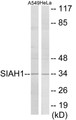 Western blot analysis of extracts from A549/HeLa cells, using SIAH1 Antibody. The lane on the right is treated with the synthesized peptide.