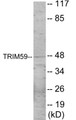 Western blot analysis of extracts from NIH-3T3 cells, using TRIM59 Antibody.