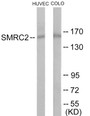 Western blot analysis of extracts from HuvEc/COLO205 cells, using SMRC2 Antibody. The lane on the right is treated with the synthesized peptide.