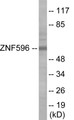 Western blot analysis of extracts from Jurkat cells, using ZNF596 Antibody.