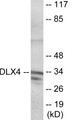 Western blot analysis of extracts from COLO cells, using DLX4 Antibody. The lane on the right is treated with the synthesized peptide.