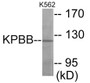 Western blot analysis of extracts from K562 cells, using KPBB Antibody. The lane on the right is treated with the synthesized peptide.