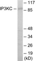 Western blot analysis of extracts from HT-29 cells, using IP3KC Antibody. The lane on the right is treated with the synthesized peptide.