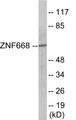 Western blot analysis of extracts from Jurkat cells, using ZNF668 Antibody. The lane on the right is treated with the synthesized peptide.