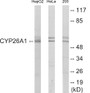 Western blot analysis of extracts from HepG2/HeLa/293 cells, using Cytochrome P450 26A1 Antibody. The lane on the right is treated with the synthesized peptide.