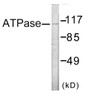 Western blot analysis of extracts from 293 cells, treated with PMA 125ng/ml 30’, using ATPase Antibody.