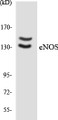 Western blot analysis of extracts from Jurkat cells, using eNOS Antibody. The lane on the right is treated with the synthesized peptide.