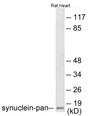 Western blot analysis of extracts from rat heart cells, using Synuclein-pan Antibody.