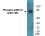Western blot analysis of extracts from HeLa cells treated with Forskolin 40nM 30', using ADD1 (Phospho-Ser726) Antibody.