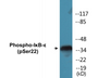 Western blot analysis of extracts from Jurkat cells treated with TNF-a 20ng/ml 30', using IkappaB-epsilon (Phospho-Ser22) Antibody.