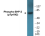 Western blot analysis of extracts from A431 cells, using SHP-2 (Phospho-Tyr542) Antibody.