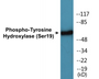 Western blot analysis of extracts from 293 cells treated with Insulin 0.01U/ml 30', using Tyrosine Hydroxylase (Phospho-Ser19) Antibody.