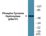 Western blot analysis of extracts from 293 cells treated with UV 15', using Tyrosine Hydroxylase (Phospho-Ser31) Antibody.