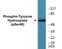 Western blot analysis of extracts from RAW264.7 cells treated with UV 30', using Tyrosine Hydroxylase (Phospho-Ser40) Antibody.