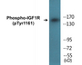 Western blot analysis of extracts from 293 cells treated with Insulin, using IGF1R (Phospho-Tyr1161) Antibody.