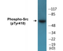 Western blot analysis of extracts from COLO205 cells treated with serum 15% 10', using Src (Phospho-Tyr418) Antibody.