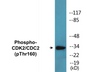 Western blot analysis of extracts from A2780 cells, using CDK2 (Phospho-Thr160) Antibody.