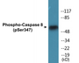 Western blot analysis of extracts from Jurkat cells, using Caspase 8 (Phospho-Ser347) Antibody.