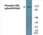 Western blot analysis of extracts from HeLa cells treated with Adriamycin 0.5ng/ml 24h, using HSL (Phospho-Ser855/554) Antibody.