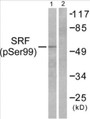 Western blot analysis of extracts from LOVO cells treated with Serum 10% 15', using SRF (Phospho-Ser99) Antibody.