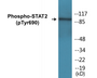 Western blot analysis of extracts from HeLa cells treated with IFN 2500U/ml 30', using STAT2 (Phospho-Tyr690) Antibody.