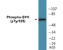 Western blot analysis of extracts from A549 cells, using SYK (Phospho-Tyr525) Antibody.