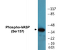 Western blot analysis of extracts from NIH-3T3 cells treated with forskolin 40 muM 30', using VASP (Phospho-Ser157) Antibody.