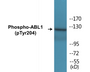 Western blot analysis of extracts from COS7 cells treated with Adriamycin 0.5ug/ml 24h, using Abl (Phospho-Tyr204) Antibody.