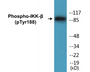 Western blot analysis of extracts from COS7 cells, using IKK-beta (Phospho-Tyr188) Antibody.