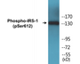 Western blot analysis of extracts from HuvEc cells treated with insulin 0.01U/ml 30', using IRS-1 (Phospho-Ser612) Antibody.
