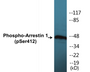Western blot analysis of extracts from COS7 cells treated with Etoposide 25uM 60', using Arrestin 1 (Phospho-Ser412) Antibody.