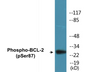 Western blot analysis of extracts from HeLa cells treated with nocodazole 1ug/ml 18h, using BCL-2 (Phospho-Ser87) Antibody.