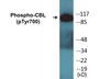 Western blot analysis of extracts from K562 cells treated with Na3VO4 0.3nM, using CBL (Phospho-Tyr700) Antibody.