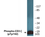 Western blot analysis of extracts from Jurkat cells treated with UV 15', using CD3 zeta (Phospho-Tyr142) Antibody.