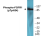 Western blot analysis of extracts from 293 cells treated with Insulin 0.01U/ml 15', using FGFR1 (Phospho-Tyr654) Antibody. The lane on the right is treated with the synthesized peptide.