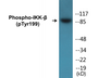 Western blot analysis of extracts from HeLa cells treated with TNF-a 20ng/ml+Calyculin A 50nM 5', using IKK-beta (Phospho-Tyr199) Antibody.