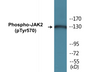 Western blot analysis of extracts from 293 cells treated with etoposide 25uM 24h, using JAK2 (Phospho-Tyr570) Antibody.